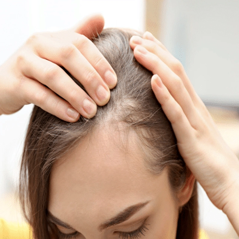 Microneedling in Palm Beach Gardens