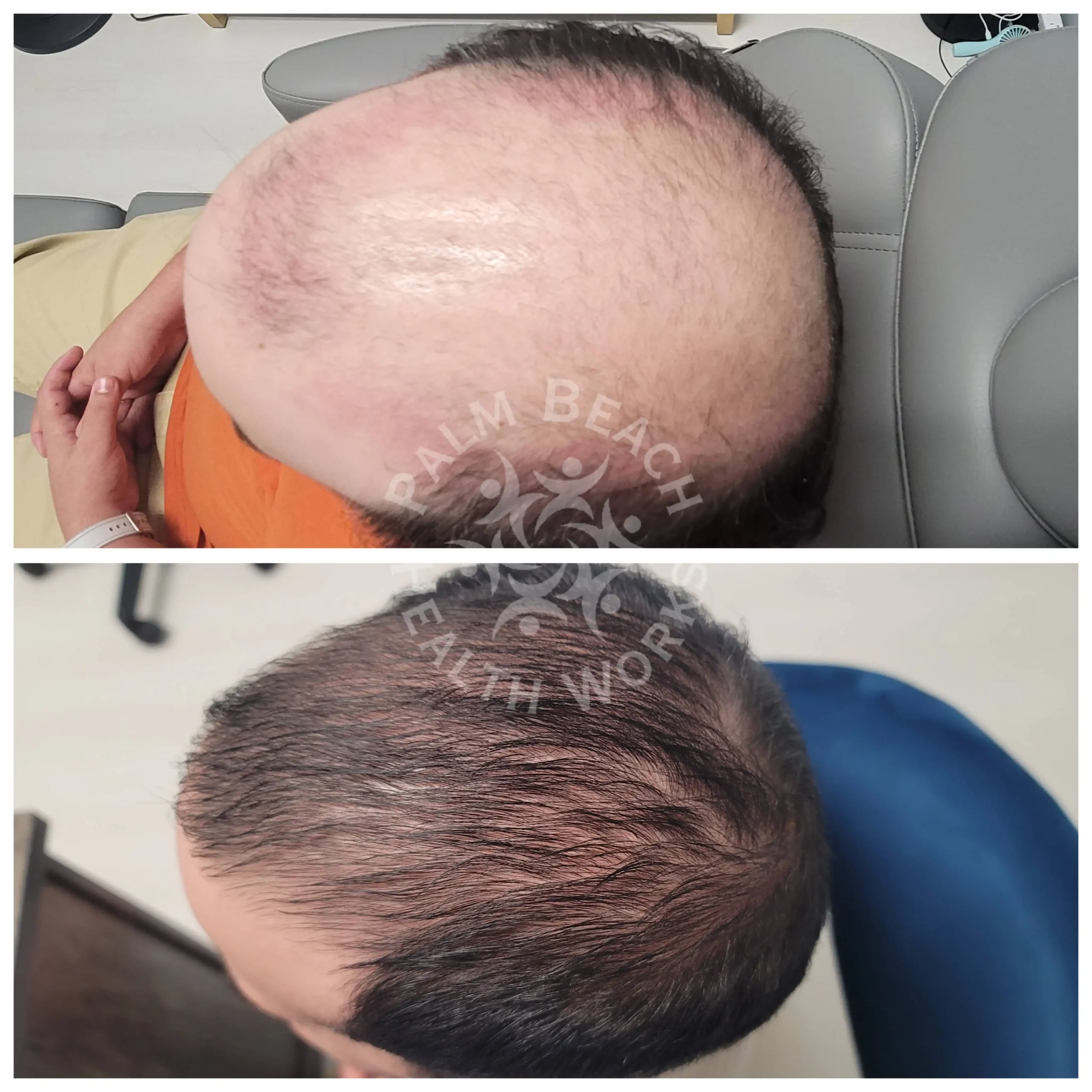After-before-02