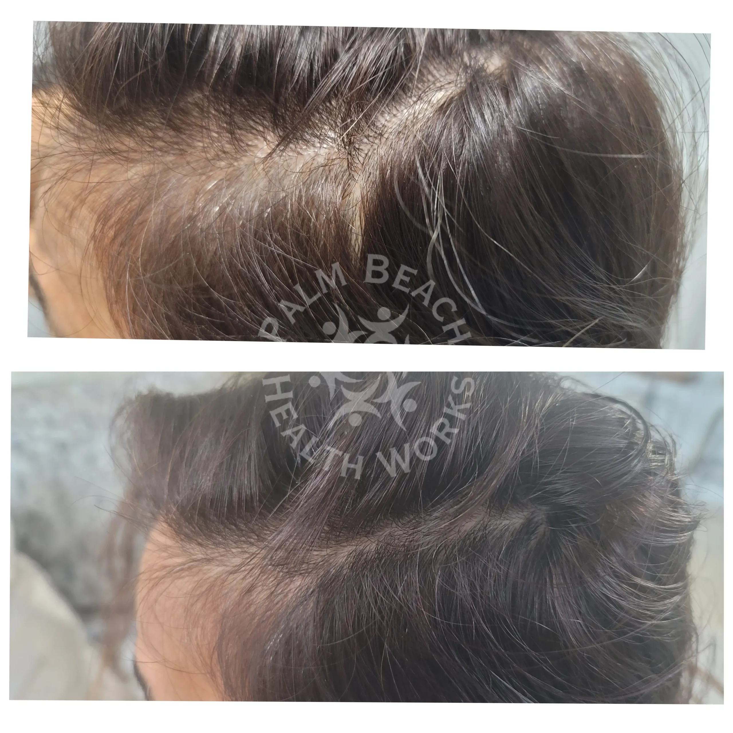 After-before-03