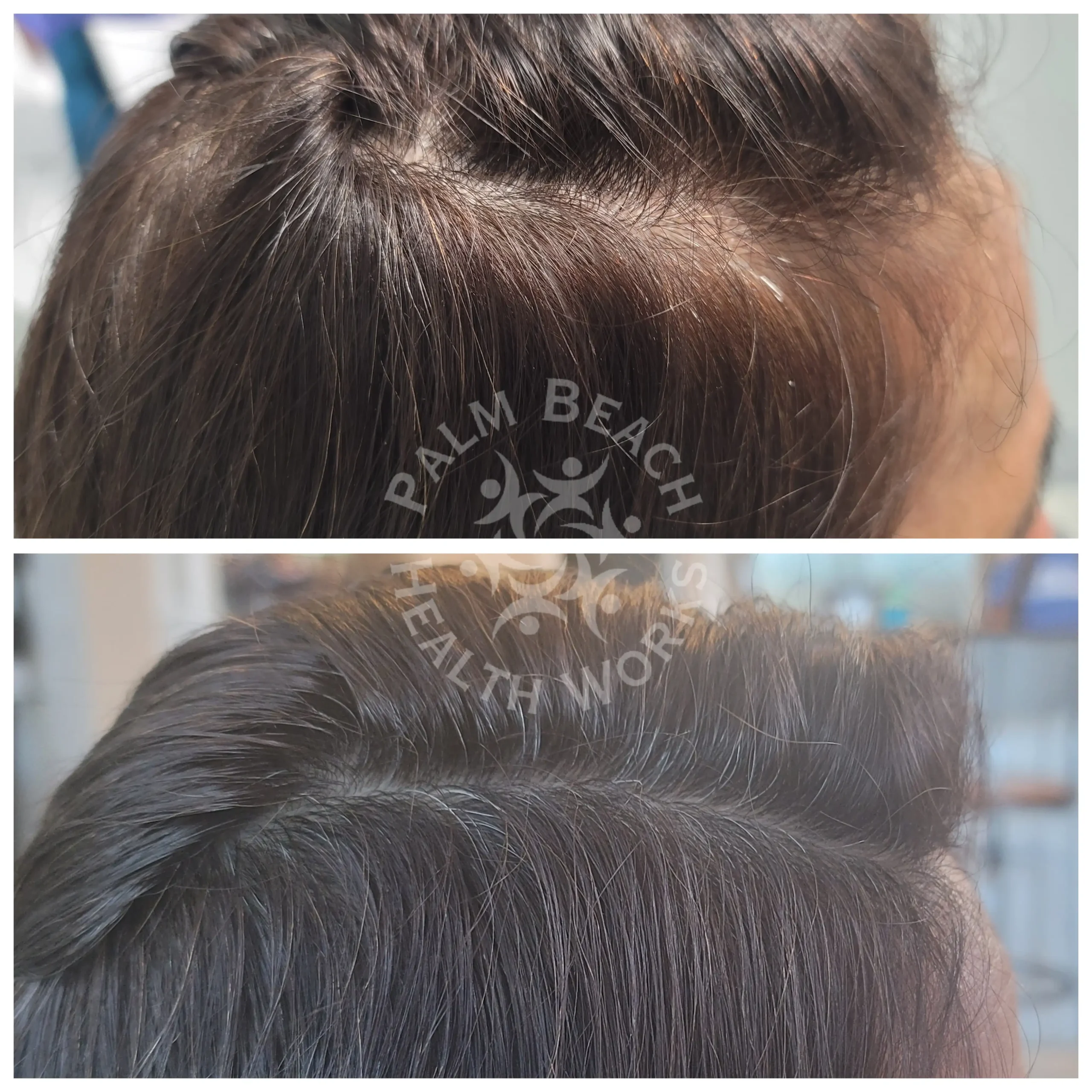 After-before-04