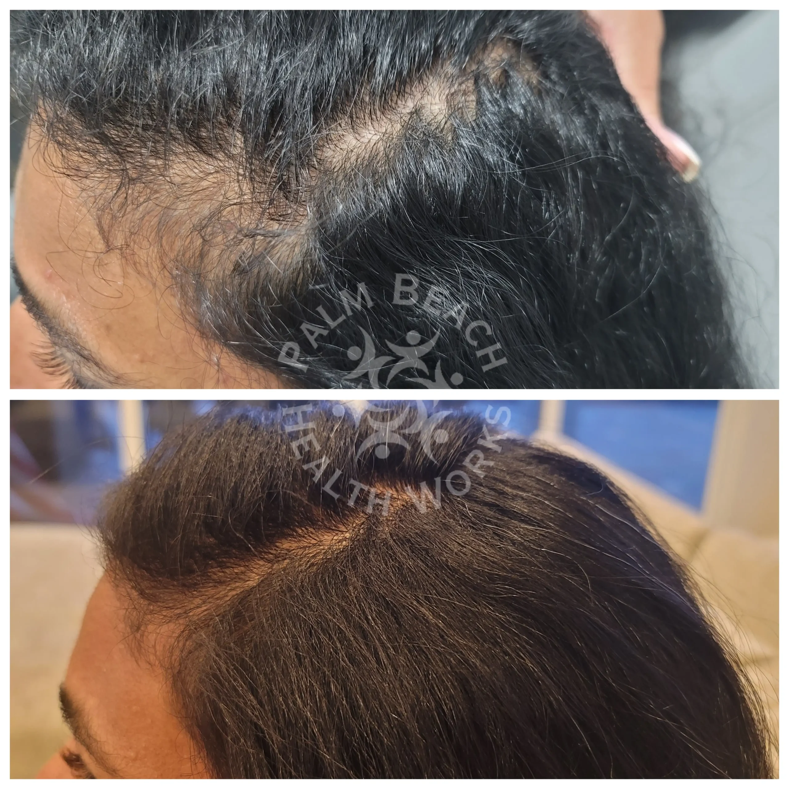 After-before-05