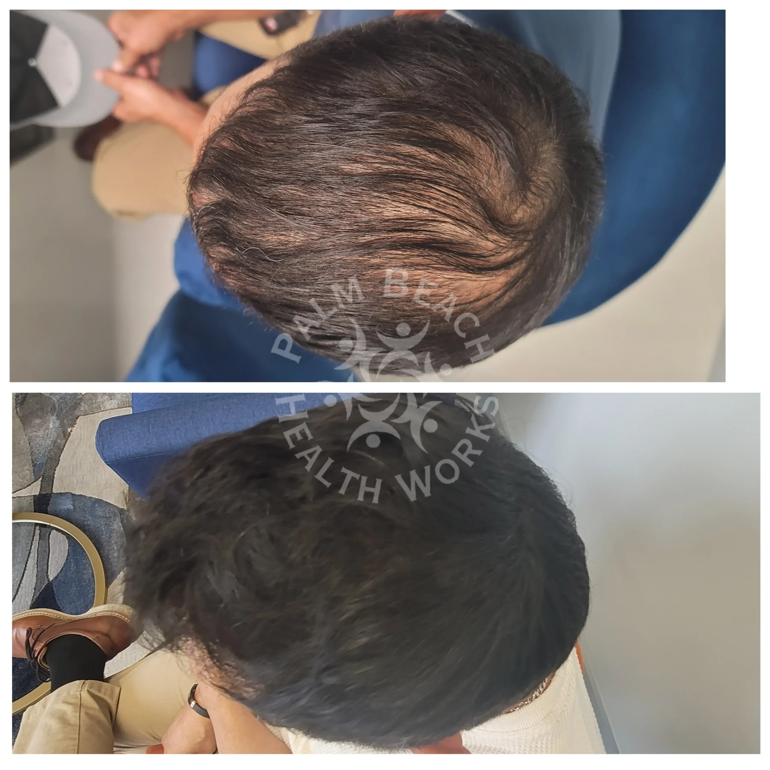 After-before-10