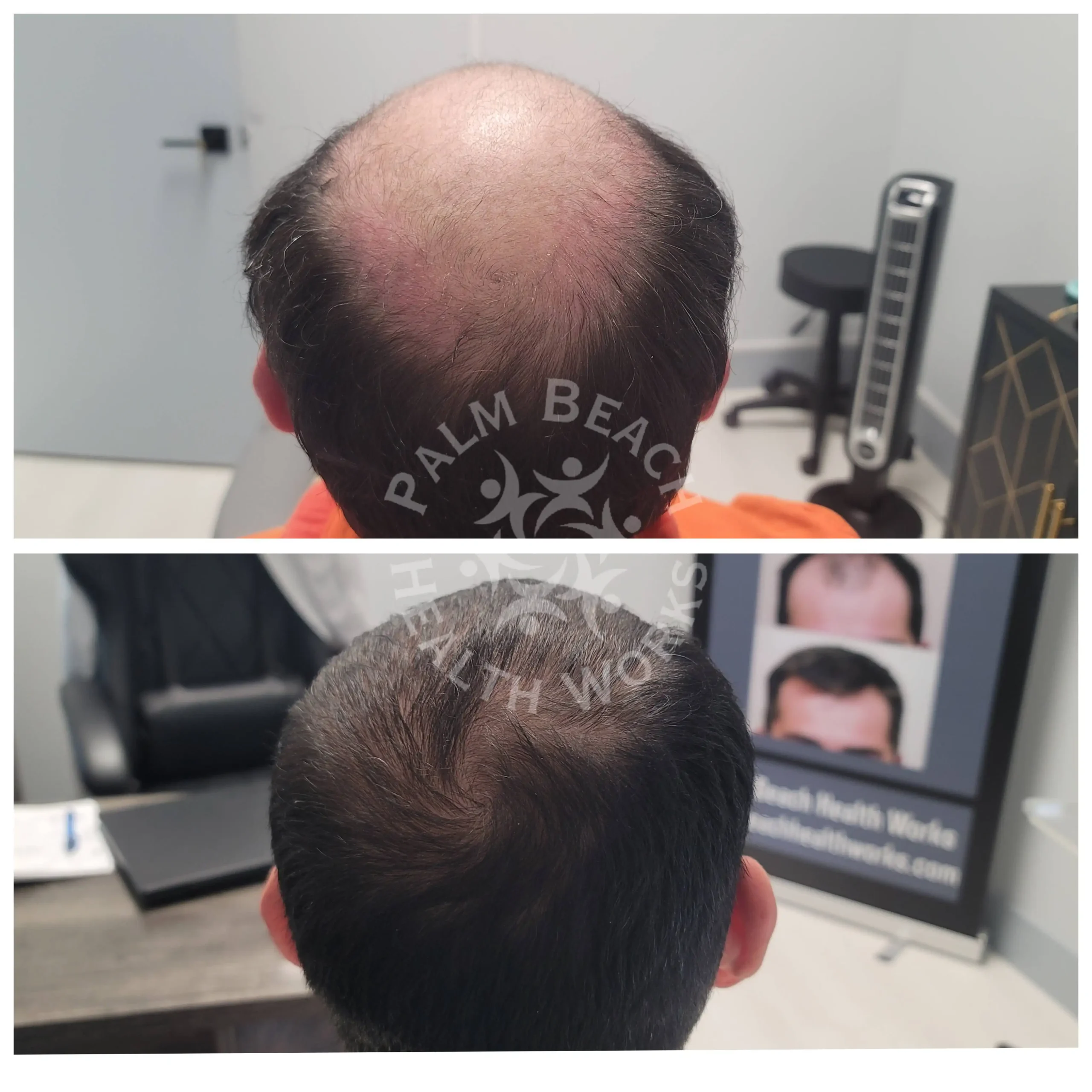 After-before-11