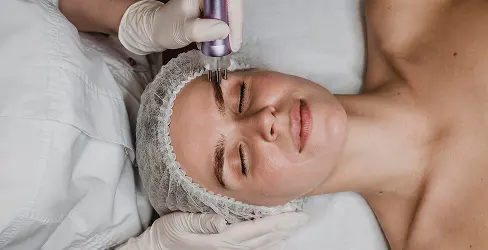 Mirconeedling