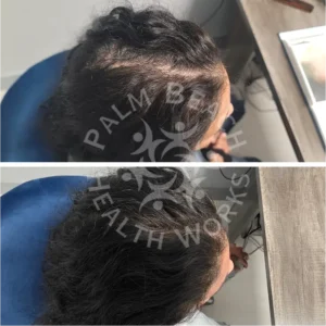 Womens Hair Loss