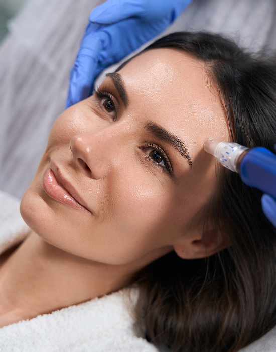 Stem Cell Based Therapy - Microneedling for Antiaging Rejuvenation