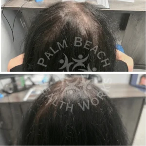 Women back